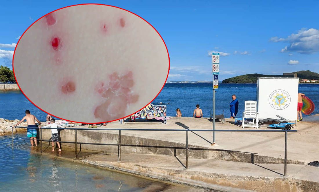 Gost prijavio fekalije na plaži otoka Ugljana: "Djeca su dobila infekciju!" Dobio je odgovor: "Vi niste prijavljeni na eVisitor"