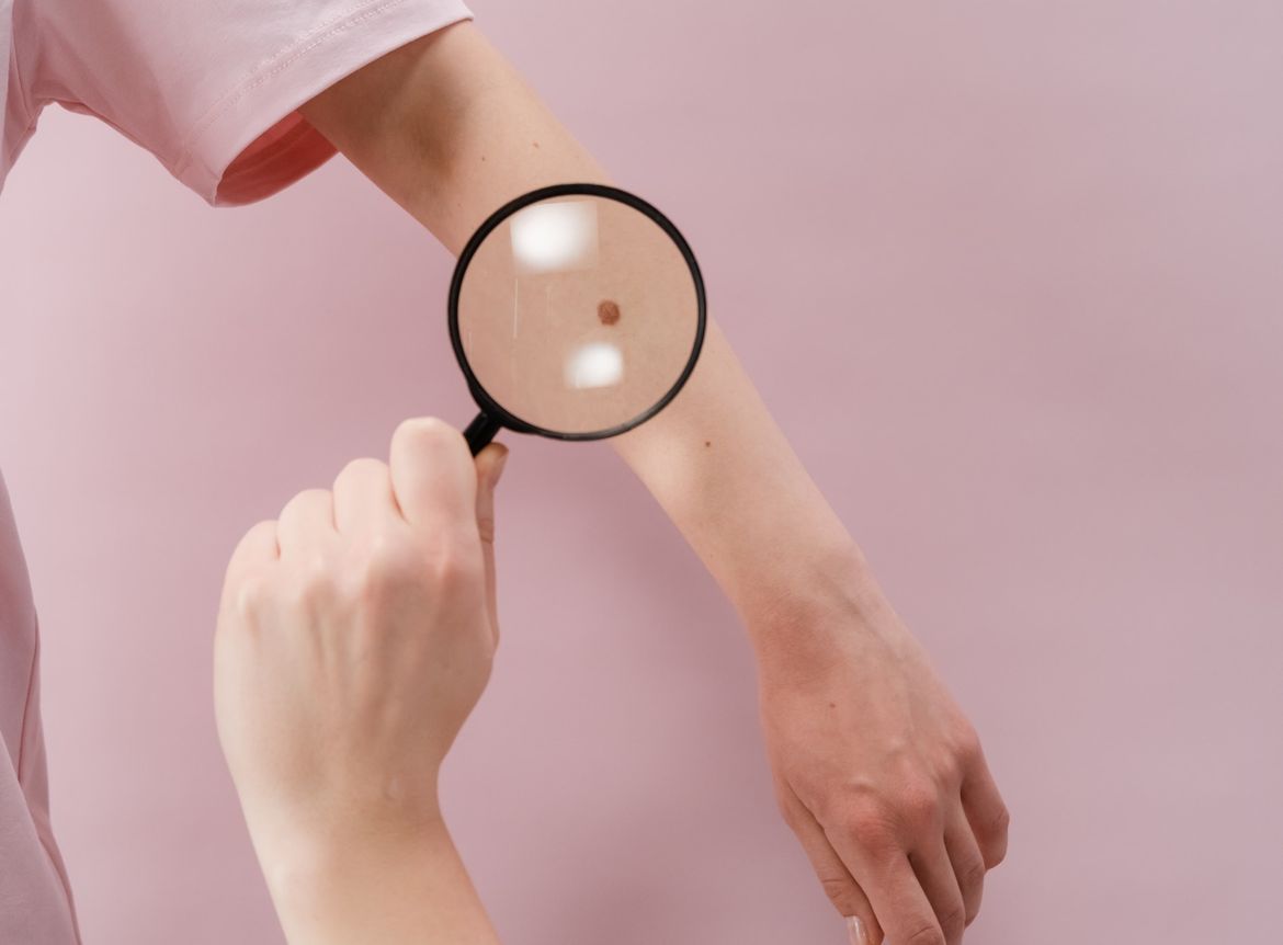 Na Korčuli i Pelješcu se održava preventivna akcija pregleda madeža