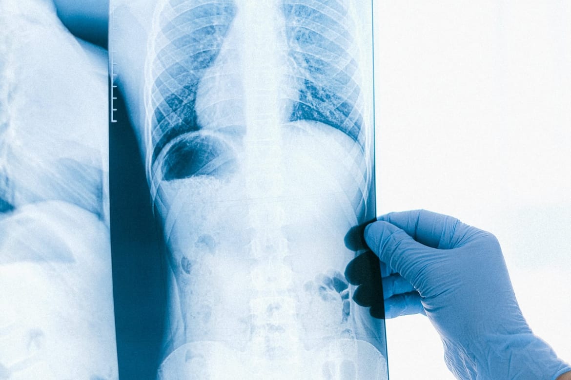 Zadarsko bolničko "čudo" -  pregled na koji u Zagrebu čekate 170 dana, u Zadru čekate 30 dana!