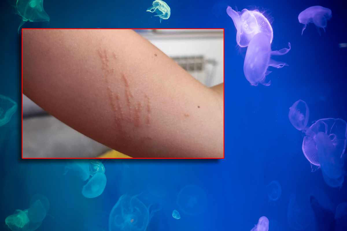 Kaštelanski zaljev krcat meduzama: "Danima nam dica iz mora izlaze opečena!"