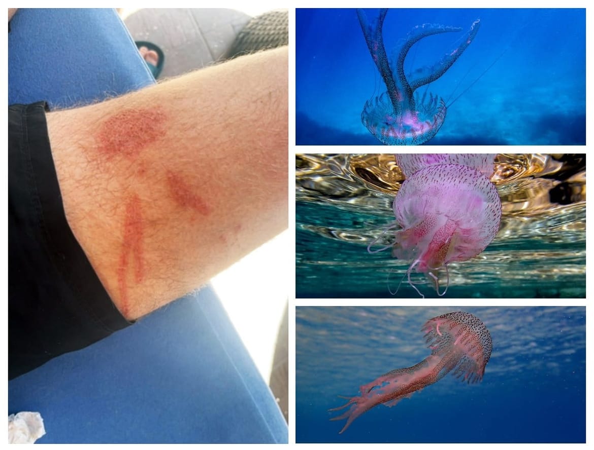 UPOZNAJTE MORSKU MJESEČINU Meduza koja je mnogima pokvarila ljetovanje na Jadranu