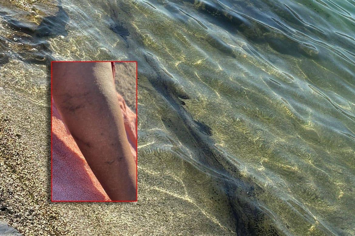 VIDEO Mazut u moru u Vranjicu: "Zamazani su i kupači!"