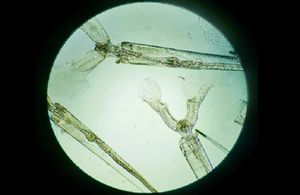 Zašto neke kupače ovih dana peče i svrbi kad izlaze iz mora?