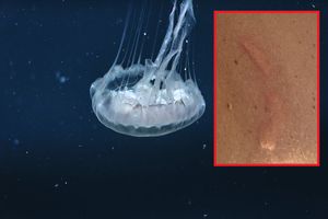 Kupače u Zadru opekle meduze - Plaža ubrzo ispražnjena