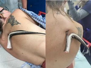 Plivala u moru pa osjetila peckanje po leđima - Uslijedio je šok: "Mislila sam da ću umrijeti"