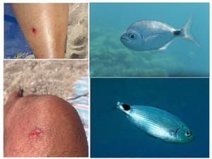 Ova vrsta ribe voli gricnuti kupače, a evo i koji ljudi bi posebno trebali pripaziti pri ulasku u more