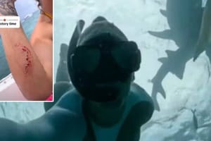 Splićanku ugrizao morski pas: "Nije ni primijetila dok nije izIšla i vidjela krv!"