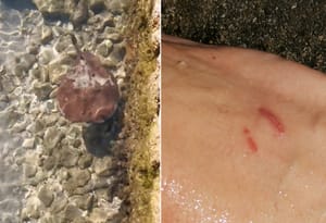 Zadranin u plićaku slučajno nagazio na drhtulju koja izaziva električni udar - Ovo je rezultat...